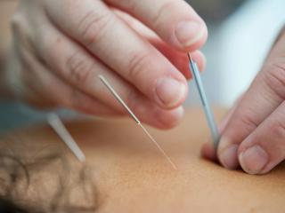 Acupuncture Whakatāne
